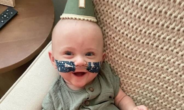 ΗΠΑ: Το πιο πρόωρο μωρό στον κόσμο γιόρτασε τα πρώτα του γένεθλια