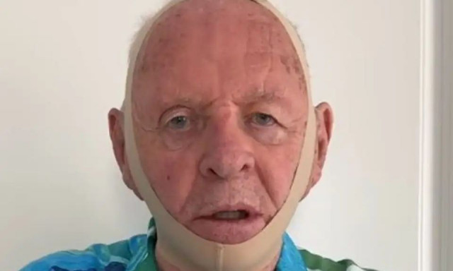 Άντονι Χόπκινς: Έγινε ξανά Χάνιμπαλ Λέκτερ και κοροϊδεύει την Κιμ Καρντάσιαν για το νέο της προϊόν