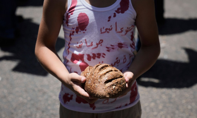 Εκατοντάδες παιδιά από τη Γάζα θα μεταφερθούν στο Ηνωμένο Βασίλειο για ιατρική φροντίδα