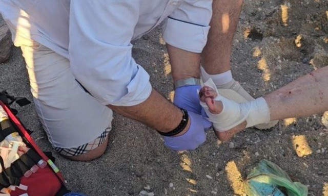 Ανάβυσσος: Θαλάσσια χελώνα έκοψε δάχτυλο γυναίκας που έκανε μπάνιο