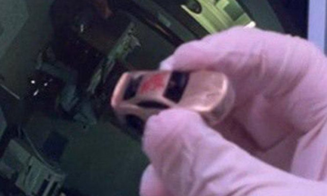 Γιατροί αφαίρεσαν αυτοκινητάκι από το στομάχι ενός παιδιού με σπάνια μέθοδο