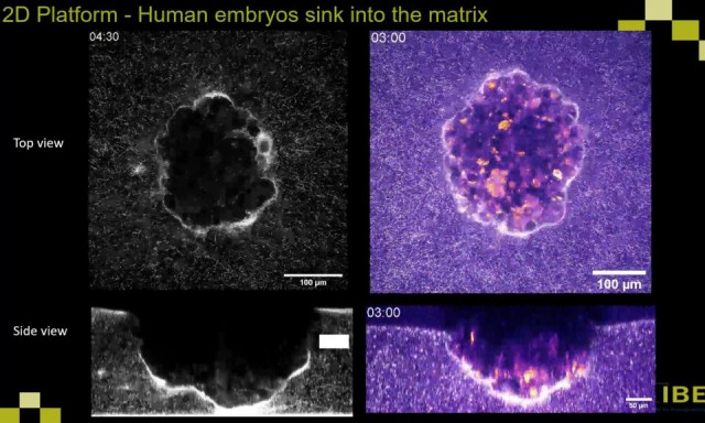 Επιστήμονες κατέγραψαν για πρώτη φορά σε βίντεο την εμφύτευση ανθρώπινου εμβρύου στη μήτρα