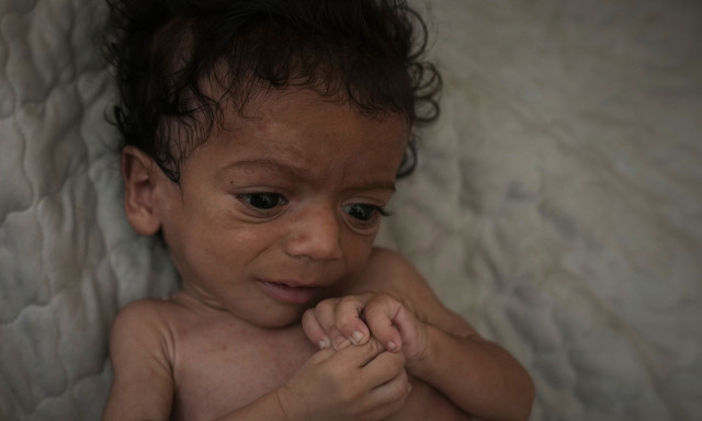 ΟΗΕ: Λιμός επιβεβαιώθηκε για πρώτη φορά στην πόλη της Γάζας