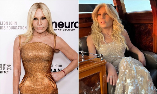 Donatella Versace: Πώς ήταν και πώς έγινε - Σοκάρουν οι φωτογραφίες μετά τις νέες πλαστικές