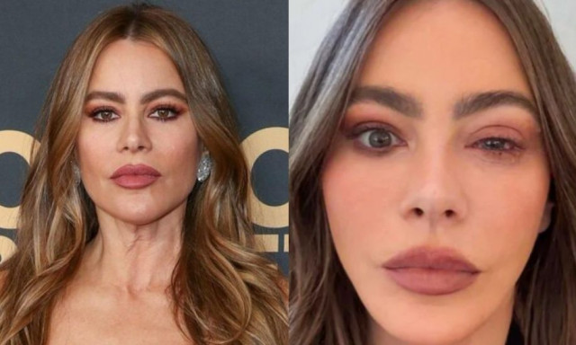 Σοφία Βεργκάρα: Έχασε την παρουσίαση των βραβείων «Emmy» λόγω αλλεργίας στα μάτια