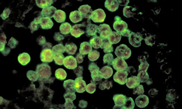 Συναγερμός στην Ινδία: Αυξάνονται τα κρούσματα εγκεφαλοφάγου αμοιβάδας - 95% η θνησιμότητα