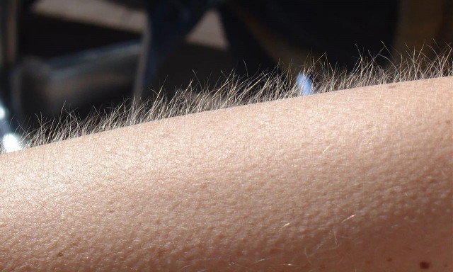 Αν ανατριχιάζετε ακούγοντας μουσική, ανήκετε σε μία ξεχωριστή ομάδα ανθρώπων