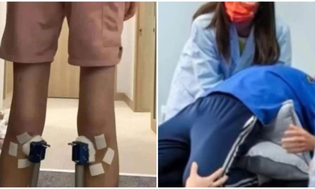 16χρονος Κινέζος ψήλωσε κατά 1,4 εκ. με «θαυματουργή» θεραπεία και επανήλθε στο ύψος του