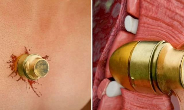 Στρατιώτης επέζησε με χειροβομβίδα στο στήθος του: Προσομοίωση εξηγεί πως τα κατάφερε