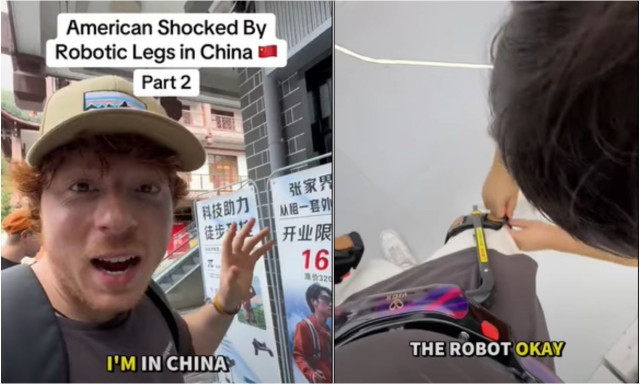 Ρομποτικά πόδια υπόσχονται να αλλάξουν τον τρόπο που κινούμαστε – Δείτε βίντεο