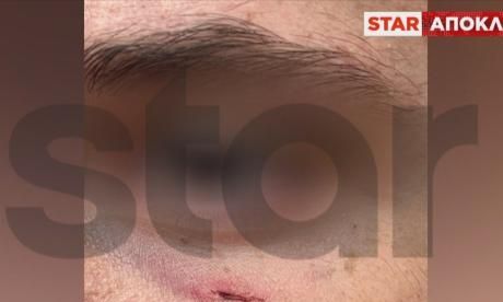 Θύμα bullying περιγράφει τον εφιάλτη που έζησε - «Ήταν 7 άτομα κι εγώ μόνος μου»