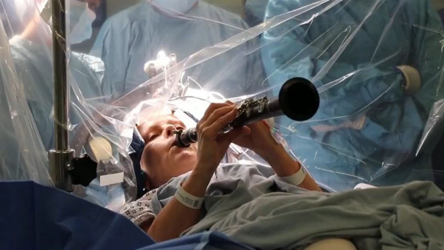 Ασθενής με Πάρκινσον παίζει κλαρινέτο κατά τη διάρκεια χειρουργικής επέμβασης στον εγκέφαλο - Video