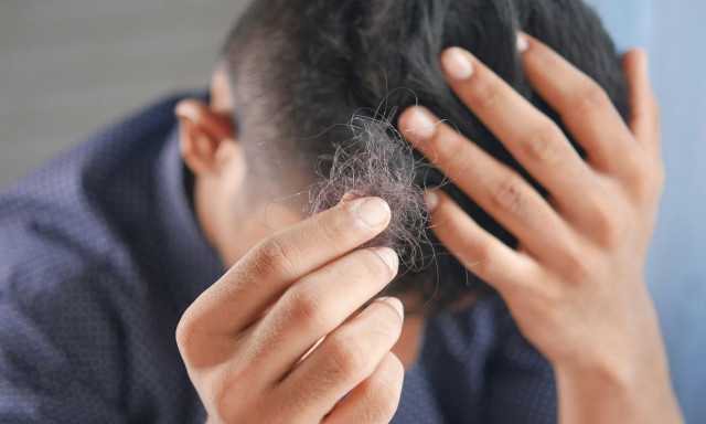 Ελπιδοφόρα έρευνα κατά της φαλάκρας: Επιστήμονες ξαναφύτρωσαν τρίχες σε άτριχα ποντίκια σε 20 μέρες