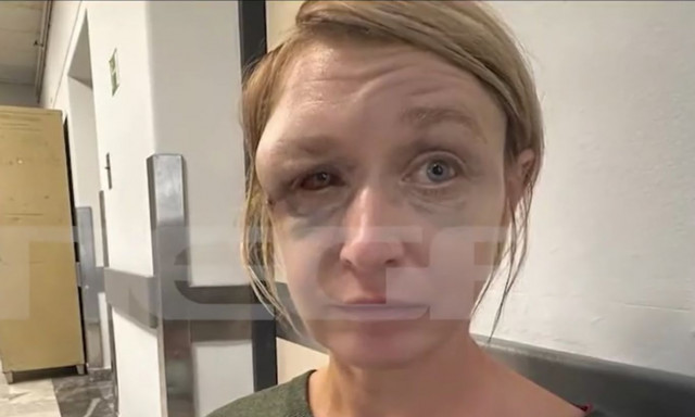 Κορωπί: «Δεν με έδειρε ο σύντροφός μου, δεν θυμάμαι πώς χτύπησα» - Τα πρώτα λόγια της Λιθουανής μέσα από το νοσοκομείο