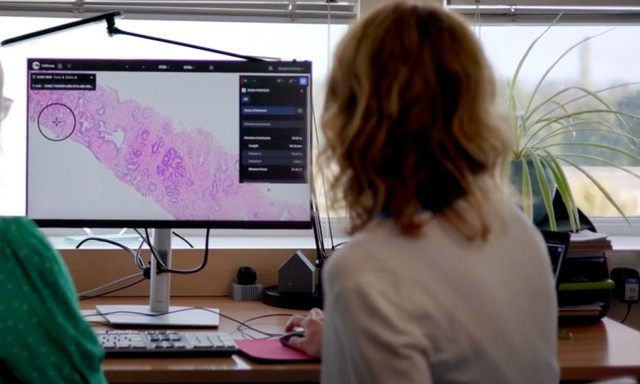 «Το 80% των ασθενών με καρκίνο του προστάτη θα θεραπευτεί» σύμφωνα με ουρολόγο