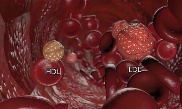 Γιατί μερικοί άνθρωποι έχουν υψηλή χοληστερόλη παρά τον υγιεινό τρόπο ζωής
