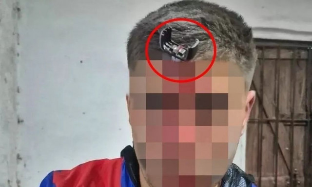 Αργεντινή: «Κάρφωσαν» κλειδί αυτοκινήτου στο κεφάλι πατέρα κατά τη διάρκεια καβγά σε αγώνα κορασίδων