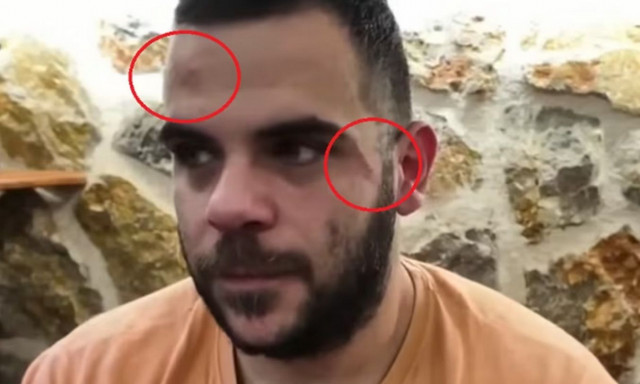 Βίντεο ντοκουμέντο: Άγριος ξυλοδαρμός πασίγνωστου Youtuber στα Γιάννενα