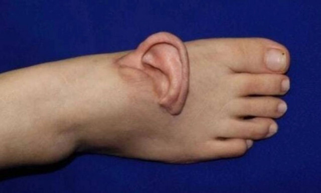 Κίνα: Φόρεσε το κομμένο αυτί στο πόδι της για 5 μήνες πριν το επανατοποθετήσει