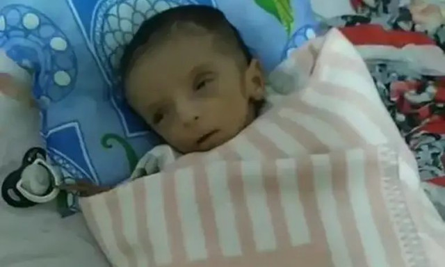 Τουρκία: Πέθανε από την πείνα βρέφος 2 μηνών - «Είδαμε ότι ήταν νεκρό, ετοιμάσαμε φαγητό και φάγαμε»