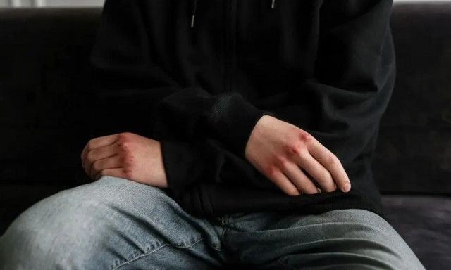 Πάτρα: 16χρονος ανάγκασε 15χρονο να γονατίσει, τον χτύπησε και τράβηξε με βίντεο την επίθεση