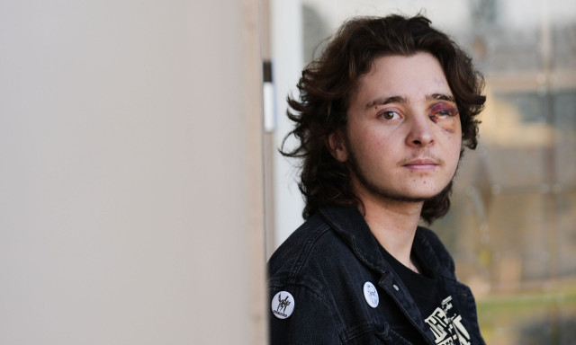 Καλιφόρνια: Πράκτορας της ICE πυροβόλησε διαδηλωτή στο πρόσωπο με βλήμα - Δείτε βίντεο