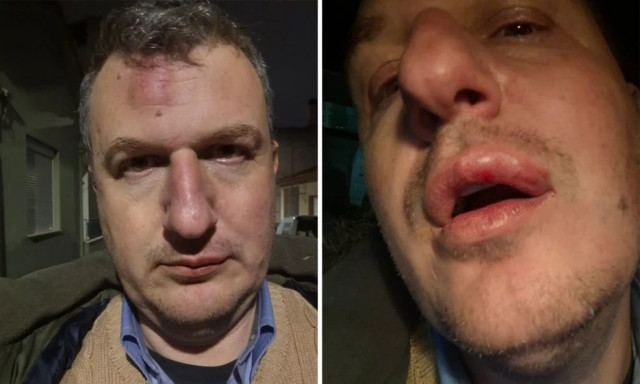 Βόλος: Ξυλοδαρμός του εκδότη της «Μαγνησίας» από αγνώστους