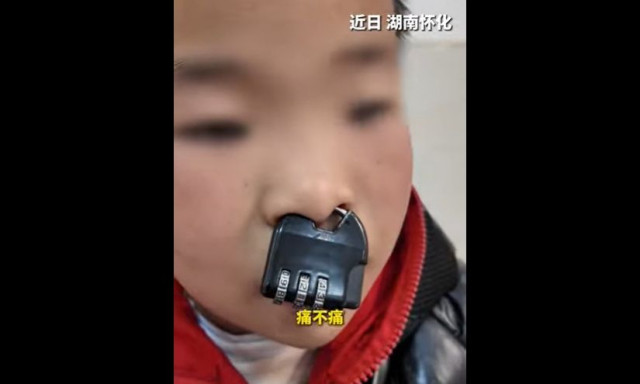 Αγόρι… σφήνωσε λουκέτο στη μύτη του – Πυροσβέστες το αφαίρεσαν με κόφτη