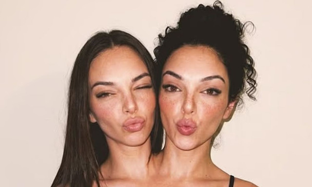 Σιαμαίες «influencers» που απέκτησαν περισσότερους από 280.000 ακόλουθους ήταν απάτη... ΑΙ!