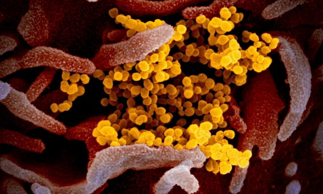 Πρώτος θάνατος εξαιτίας του ιού Nipah στο Μπαγκλαντές - Μεγάλη ανησυχία μετά τα κρούσματα στην Ινδία