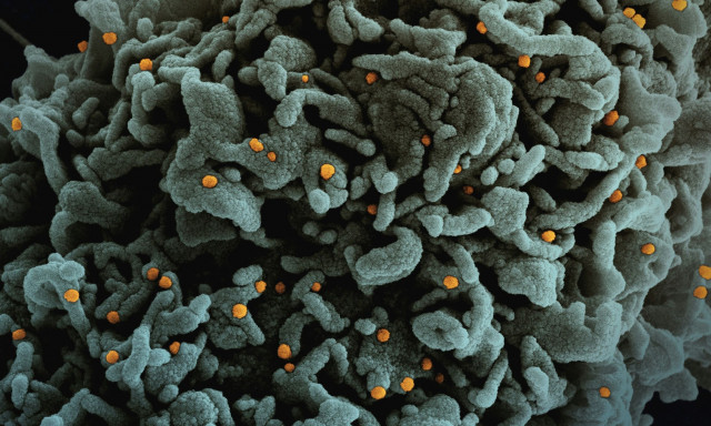 ΕΛΠΙΔΑ: Σχεδόν 400 παιδιά τον χρόνο διαγιγνώσκονται με καρκίνο