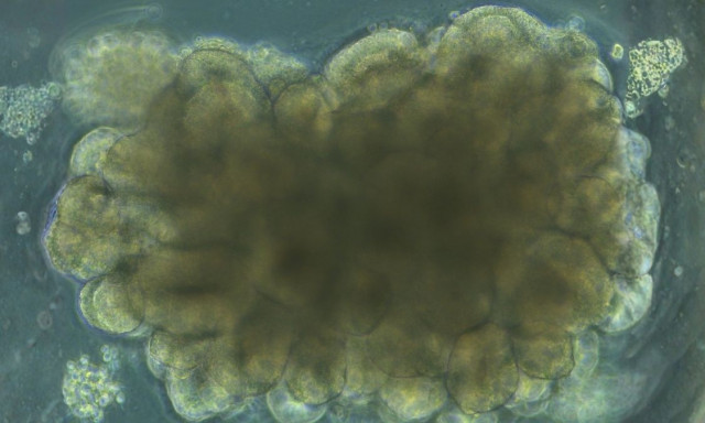 Επιστήμονες καλλιέργησαν μίνι εγκεφάλους και τους εκπαίδευσαν να λύσουν ένα τεχνικό πρόβλημα