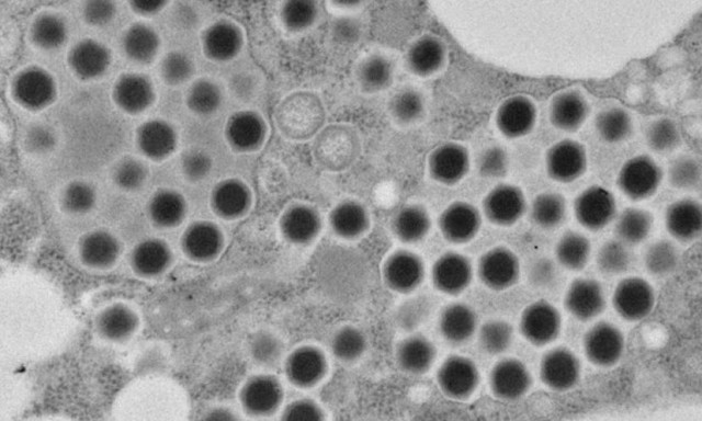 Ushikuvirus: Η ανακάλυψη ενός ιού στην Ιαπωνία ανοίγει ξανά τη συζήτηση για την εξέλιξη των κυττάρων