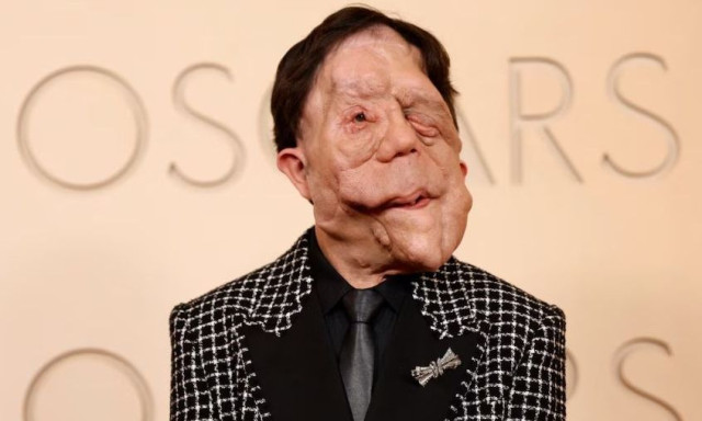 Άνταμ Πέρσον: Συγκλόνισε στο κόκκινο χαλί των Όσκαρ - Η μάχη του με την νευροϊνωμάτωση