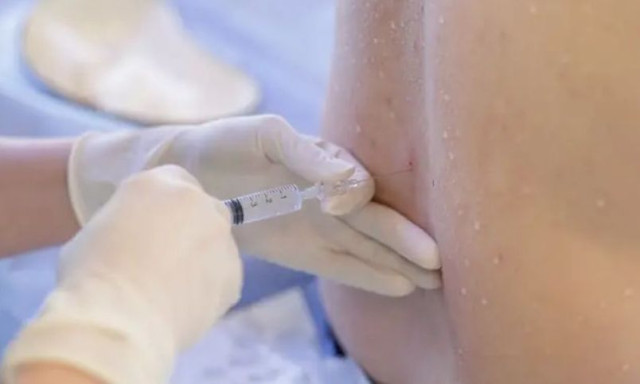 Οι πιο επώδυνες επεμβάσεις σύμφωνα με ειδικούς – Τι λέει η επιστήμη για τον πόνο