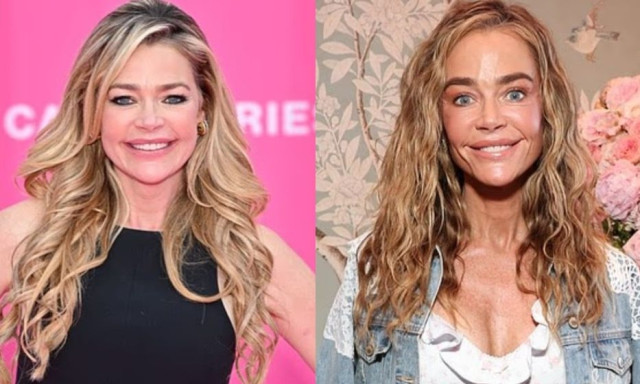 Τι κρύβεται πίσω από τις ακραίες αλλαγές στην εμφάνιση της Denise Richards