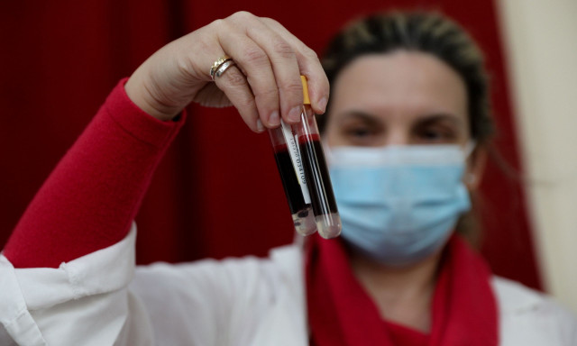 Το 19% των Ελλήνων έχει υψηλή Lp(a) - Γιατί η λιποπρωτεΐνη-α αυξάνει τον κίνδυνο για καρδιαγγειακά