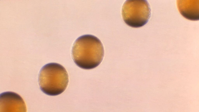 Μηνιγγίτιδα: Σκοτώνει πάνω από 250.000 ανθρώπους παγκοσμίως κάθε χρόνο