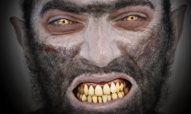 Κλινική Λυκανθρωποπάθεια: Όταν ο εγκέφαλός σας επιμένει ότι μεταμορφώνεστε σε ζώο!