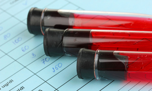 Οι 4 πρωτοπαθείς καρκίνοι που αυξάνουν την πιθανότητα μετέπειτα λευχαιμίας