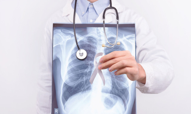 Αυξάνεται ο καρκίνος του πνεύμονα σε μη καπνιστές: Αιτίες και πρώιμα συμπτώματα που πολλοί υποτιμούν