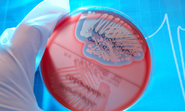 Λοίμωξη από σταφυλόκοκκο: Πρώιμα σημάδια - Τι να κάνετε αμέσως