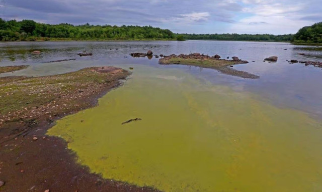 Βακτήρια που «τρώνε» τη σάρκα εντοπίστηκαν σε ύδατα – Τα θύματα μπορεί να πεθάνουν μέσα σε 48 ώρες