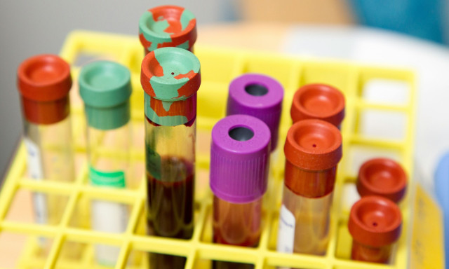 Λύθηκε μυστήριο 50 ετών για τις ομάδες αίματος - Τι αποκάλυψε νέα επιστημονική έρευνα