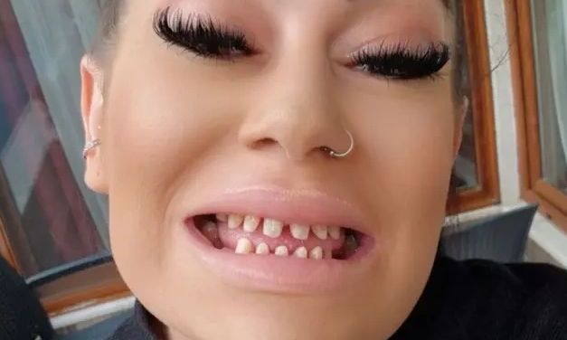 Πλήρωσε 20.000 ευρώ για να βάλει δόντια στην Τουρκία αλλά τώρα δεν μπορεί να φάει