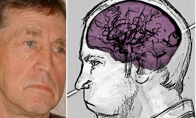 Ο σοβιετικός επιστήμονας που επέζησε από την πρόσκρουση μιας δέσμης πρωτονίων στο κεφάλι του