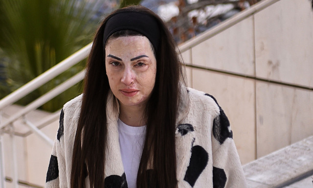 Ιωάννα Παλιοσπύρου: Συγκινεί 6 χρόνια μετά την επίθεση με βιτριόλι - Η ζωή είναι το πιο όμορφο δώρο