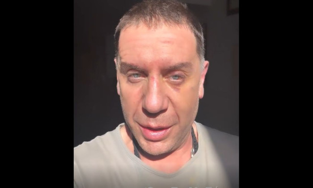 Γιώργος Μαζωνάκης: «Μην ξανακούσω κανέναν να πει ότι δεν θα γίνει η συναυλία της Θεσσαλονίκης»