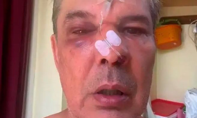 Ξυλοκόπησε άγρια άνδρα μέσα σε ιατρείο όταν του έκανε παρατήρηση να μιλά πιο σιγά στο κινητό