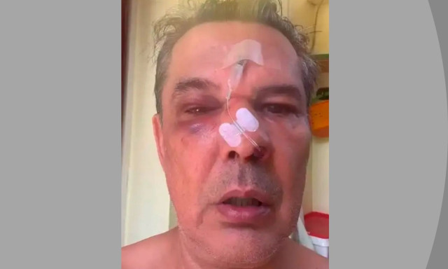Χαϊδάρι: Τι δήλωσε το θύμα ξυλοδαρμού από «τραμπούκο» σε ιατρείο - Γνωστός επιχειρηματίας ο δράστης
